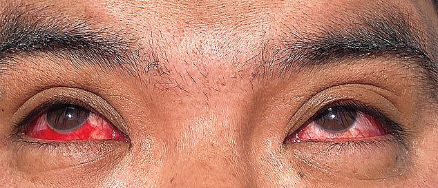 Alarming development as mutated bird flu strain that is 30x deadlier leaves American infected