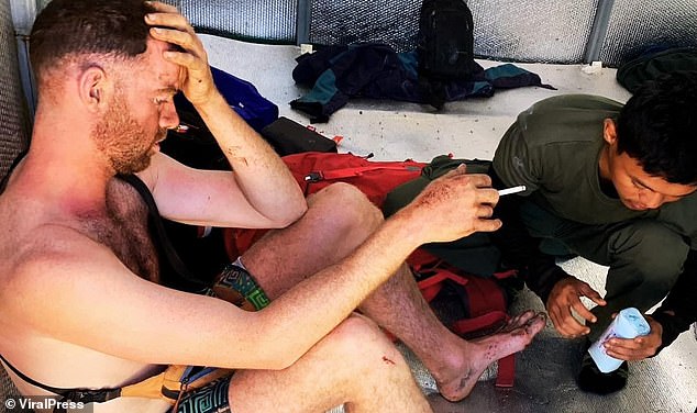 Smoking! Irish tourist tumbles 650ft down Indonesian volcano and somehow survives before lighting up and making solemn vow to rescuers