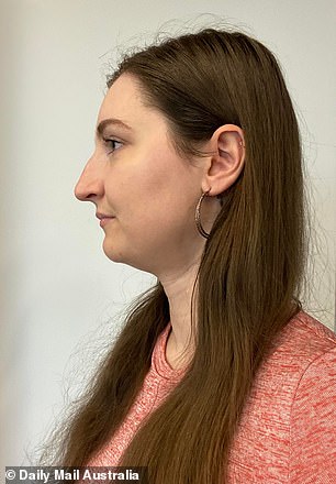 How I get rid of my double chin in seconds: ‘Mewing’ beauty trend sculpts your face using only your tongue