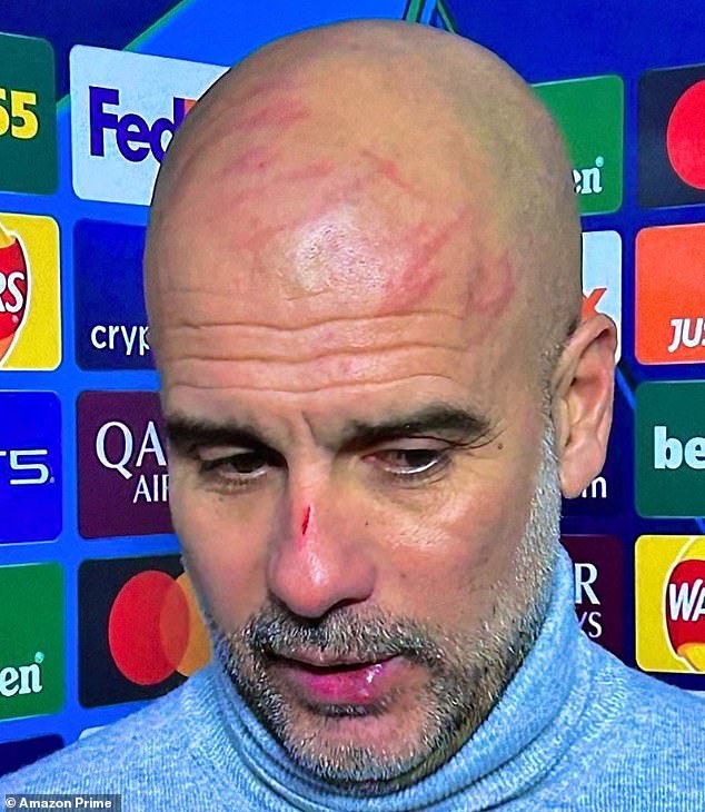 Five signs your stress levels are high enough to kill you…after Pep Guardiola sparks concern with alarming stress wounds
