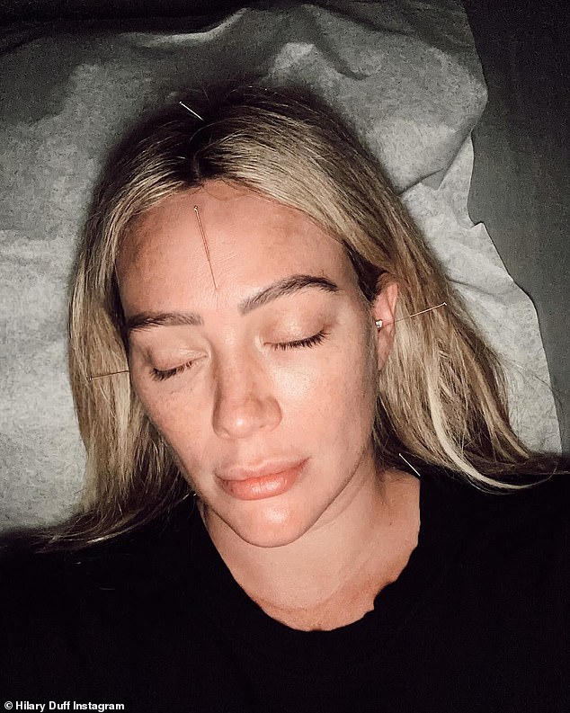 Pregnant Hilary Duff gets acupuncture ahead the imminent birth of fourth child: ‘Gently trying to give baby the eviction notice’