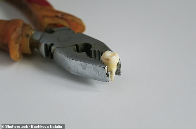 Dental MAYHEM: A quarter of Brits who can’t get a dentist appointment resort to ‘using pliers’ or ‘Turkey teeth’, shock report finds