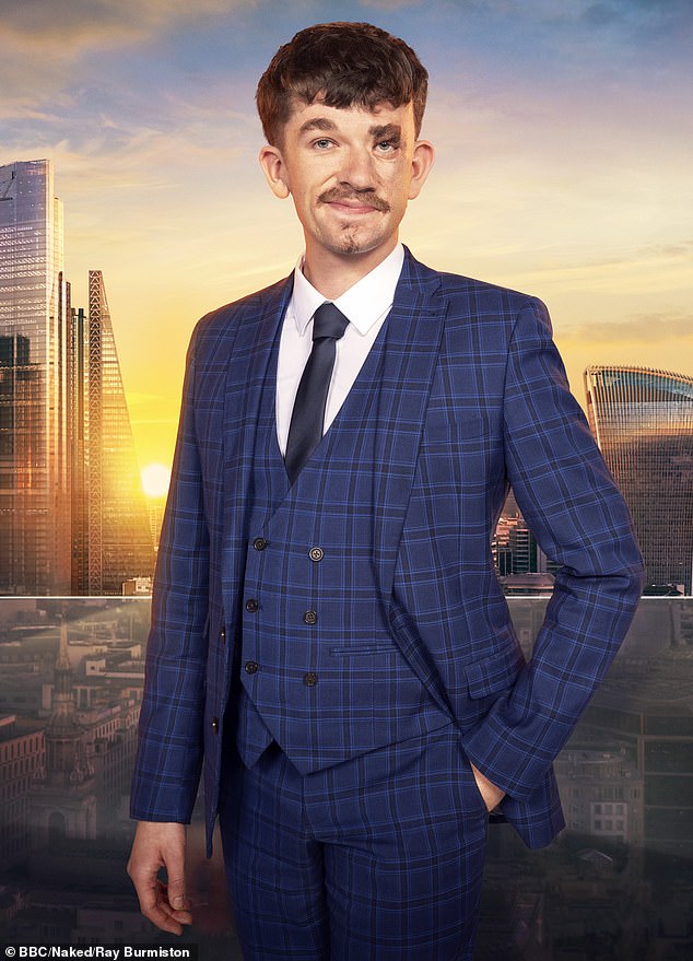 The truth about cancer-causing condition that affects one in 20,000 – after Apprentice hopeful Jonny Heaver’s revelation about his face