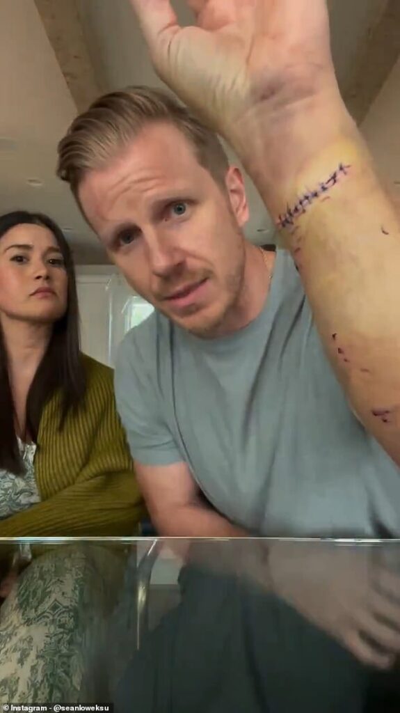 Bachelor star almost killed by his own family dog after two brutal attacks in 12 hours