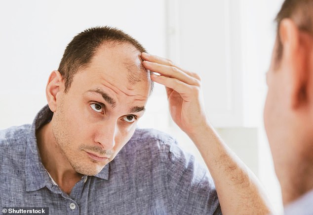 Good news for bald men! Scientists have developed a simple way to reverse hair loss – and say a treatment could be available by 2029