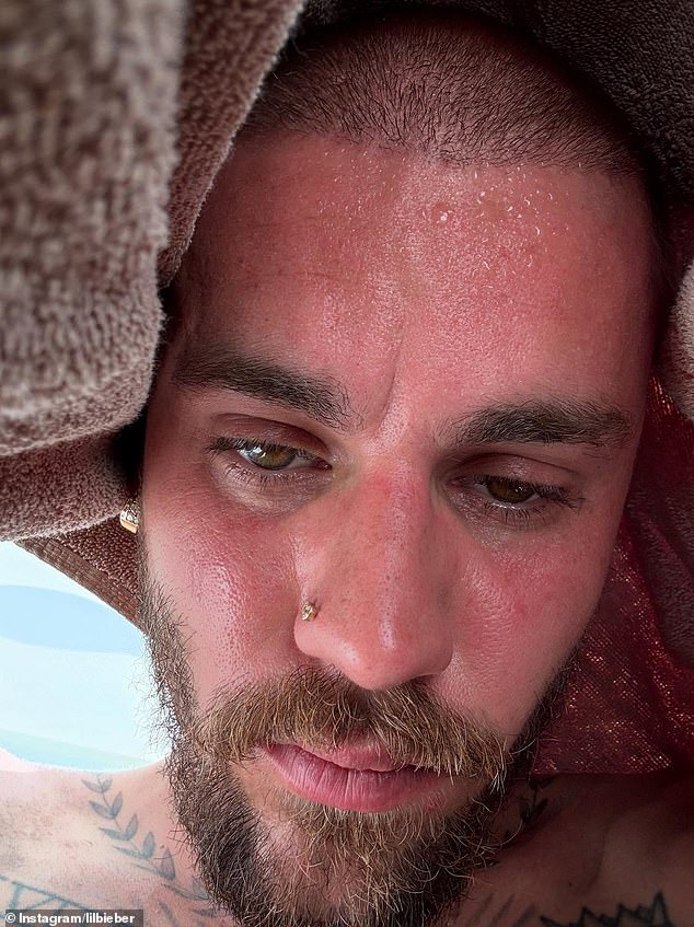 Justin Bieber shares sweaty ‘detox’ selfie just hours after worrying fans with drug-fueled session