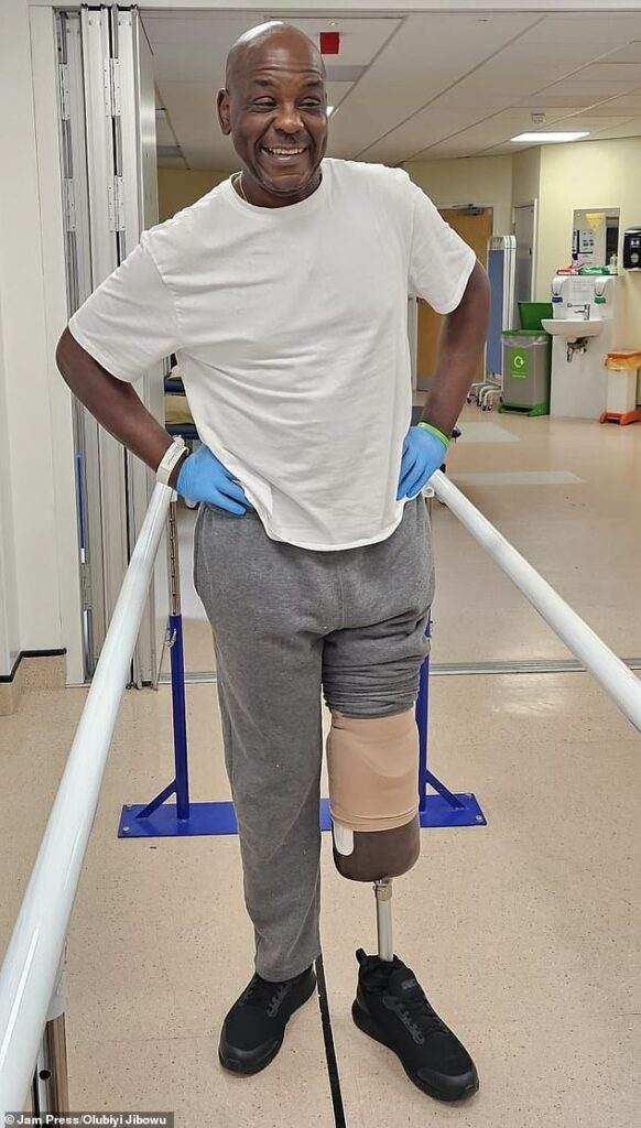 Man has to have his leg amputated after first aid mistake