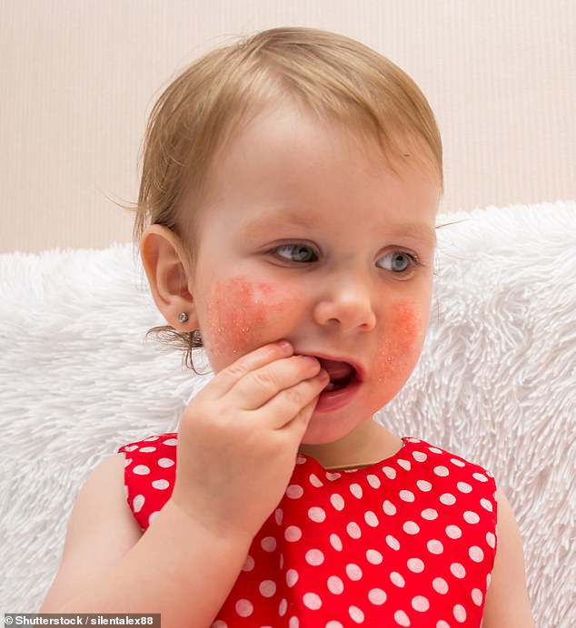 Dermatologists’ horror as babies aged just six months are treated for skin conditions caused by wearing ‘too much perfume and makeup’
