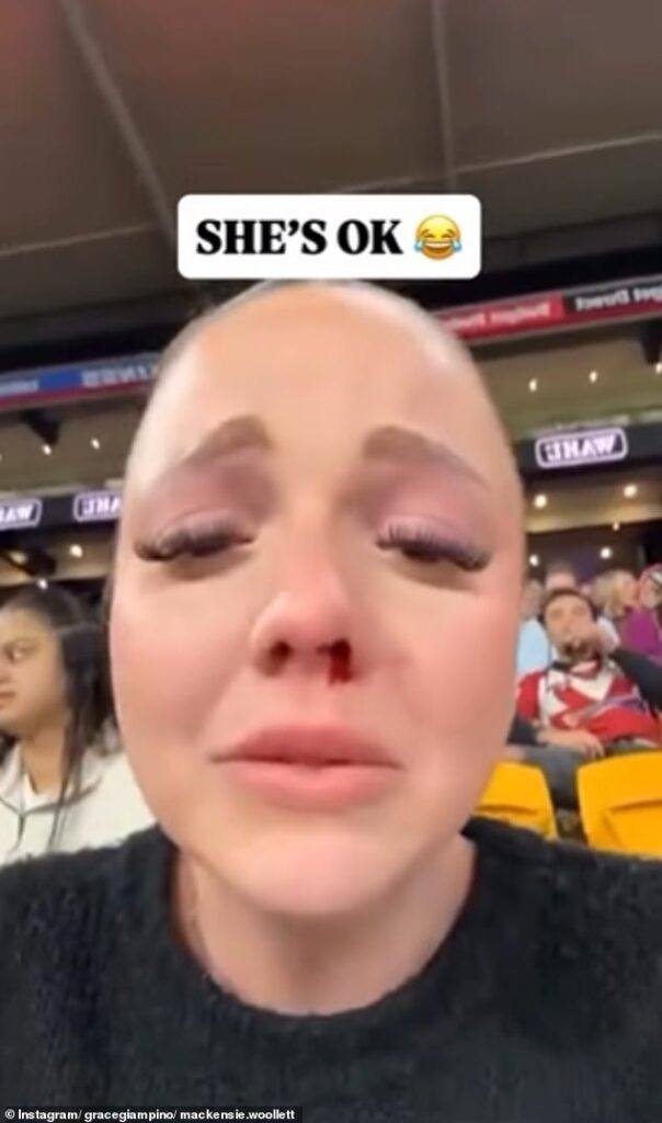 Woman reveals the moment a kick from one of the NRL’s biggest stars accidentally left her with a bloodied nose