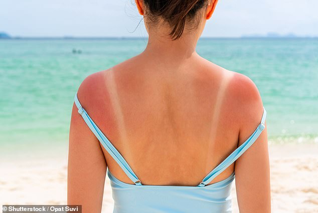 Take the test that reveals how likely you are to get deadly skin cancer