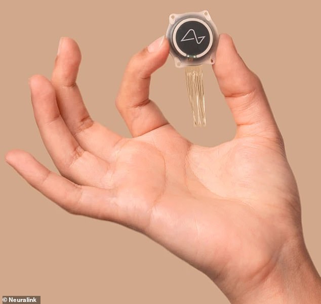 Britons to receive Elon Musk’s brain chips in new clinical trial – as paralysed woman reveals the implant’s shocking effects