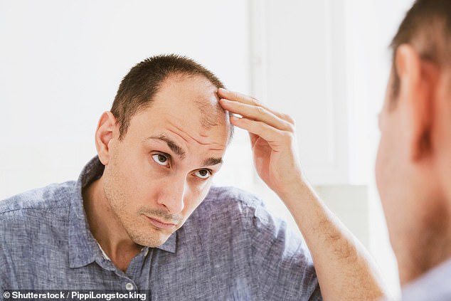Drink enjoyed by millions every day ‘could trigger hair loss’, experts warn