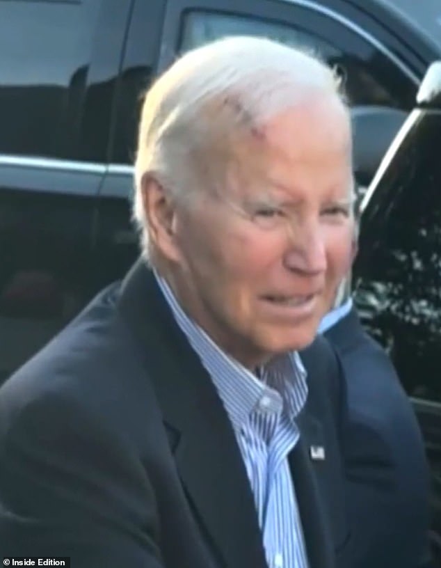 Concerns for frail ex-president Joe Biden as he wobbles through meet-and-greet with shocking head wound