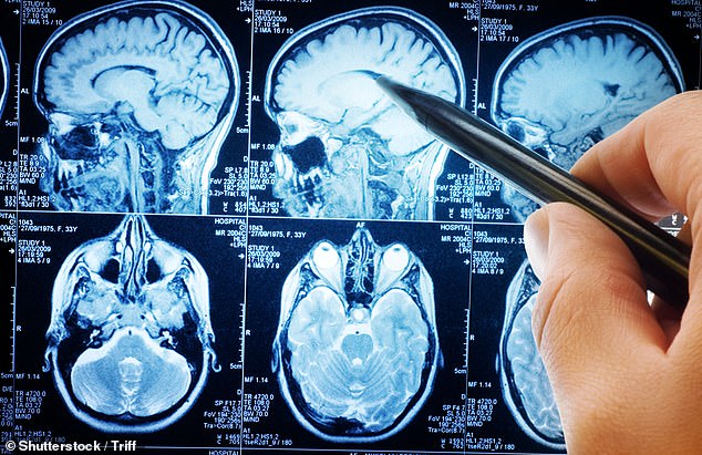Health problem that affects 1 in 4 could massively increase risk of dementia, experts discover