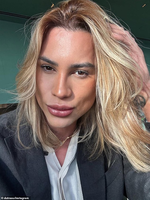 Brazilian fashion influencer Junior Dutra dies at age 31 after alleged ‘fox eyes’ procedure complications